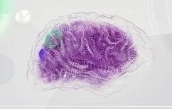Stress response system and emotional processing pathways